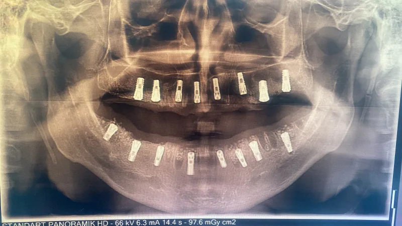 Alanya HEALTHY TEETH Dental Aesthetic — Medizin in Alanya: Online-Bestellung, Preise und Bewertungen