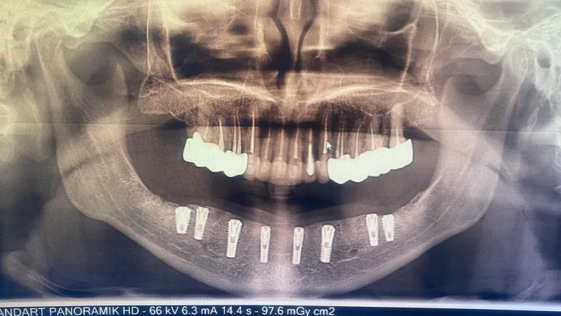 Alanya HEALTHY TEETH Dental Aesthetic — Medizin in Alanya: Online-Bestellung, Preise und Bewertungen