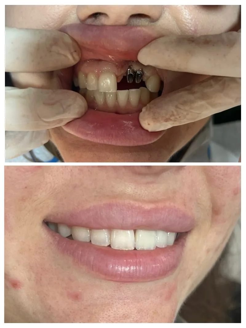 Alanya HEALTHY TEETH Dental Aesthetic — Medizin in Alanya: Online-Bestellung, Preise und Bewertungen